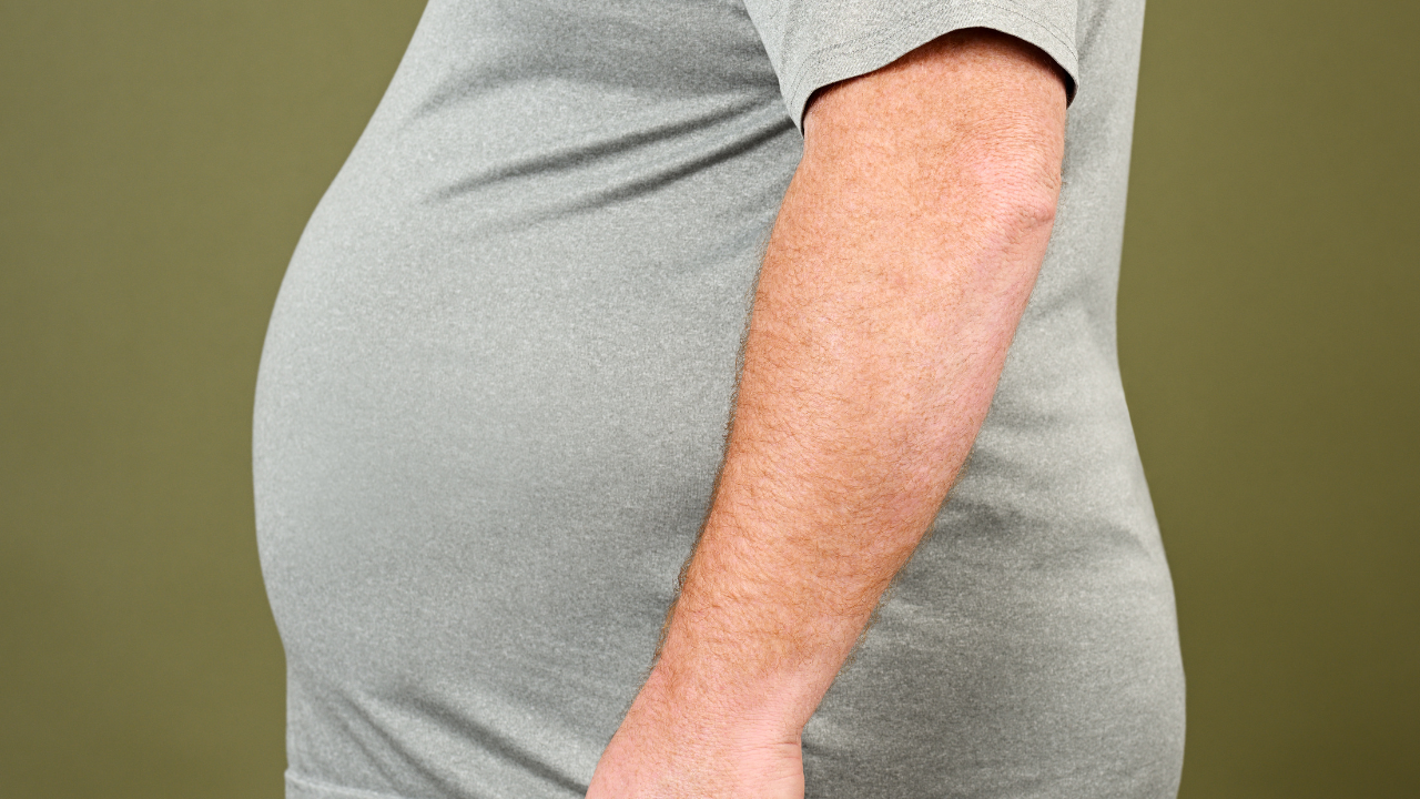 Cirurgia bariátrica particular ou pelo convênio em São Paulo: qual vale mais a pena?