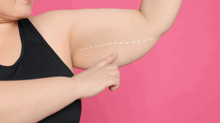 Bariátrica com 6 meses de plano: é possível ou preciso esperar mais?