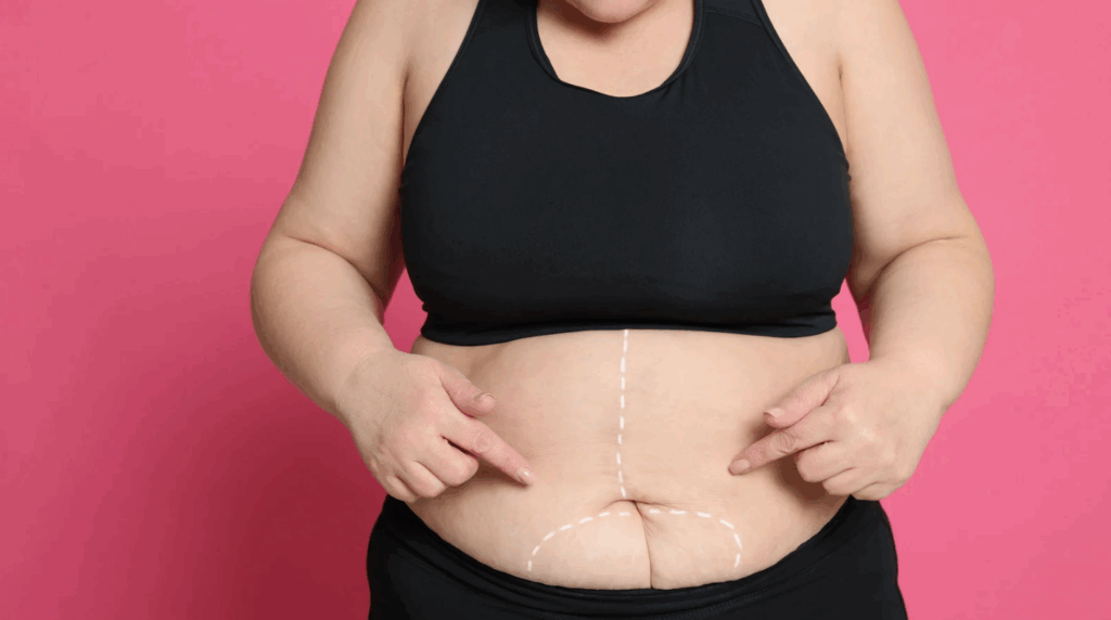 Plano de saúde cobre cirurgia bariátrica? Entenda o que diz a ANS e como funciona