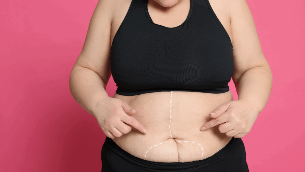 Plano de saúde empresarial cobre cirurgia bariátrica?