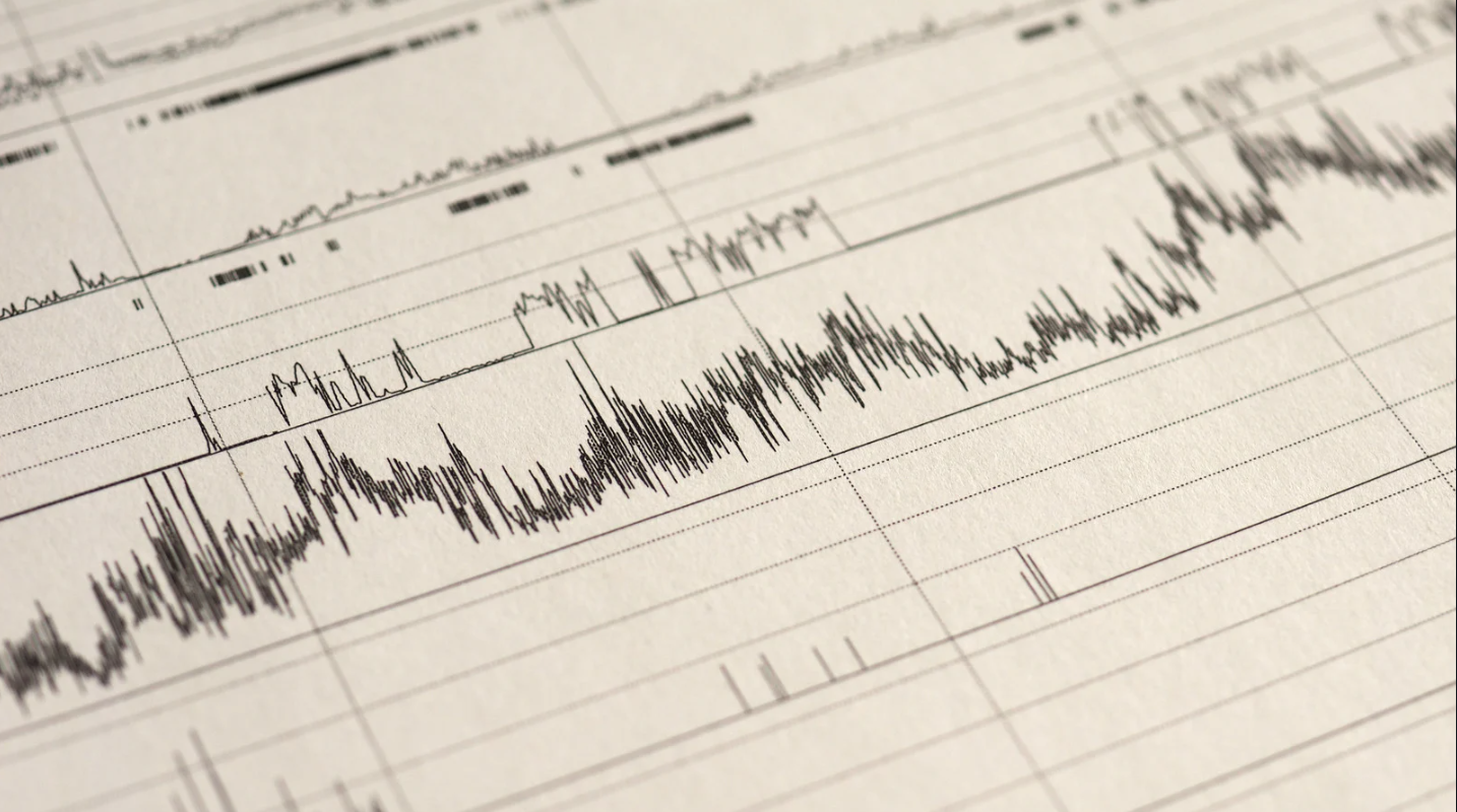 Agendar polissonografia em São Paulo: descubra o que está afetando o seu sono