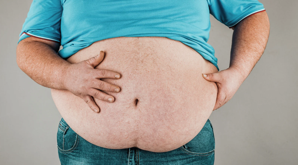 Como funciona o tratamento da obesidade?
