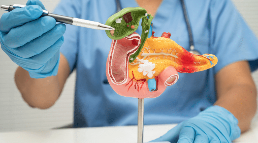 Riscos do Mounjaro para o Pâncreas e Histórico de Pancreatite
