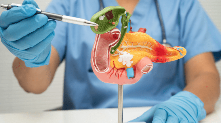 Riscos do Mounjaro para o Pâncreas e Histórico de Pancreatite